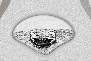 Neurogenní měchýř aneb diagnóza v plenkách - Médium.cz